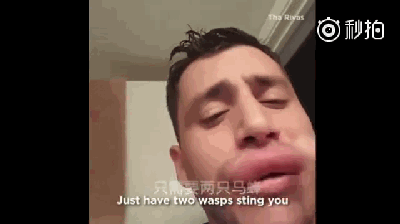 画面太美:现实版梁朝伟的香肠嘴走红 只需两只黄蜂