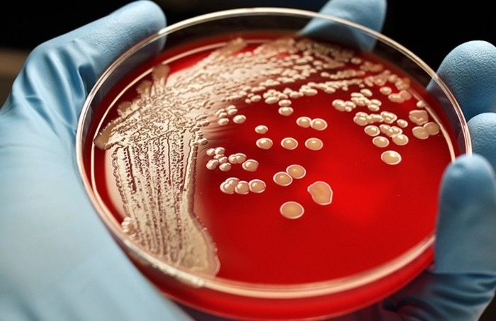 研究人员开发出革命性新化合物：能对抗耐抗生素细菌